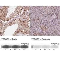Anti-TOPORS antibody produced in rabbit 
