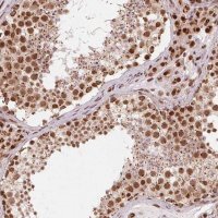 Anti-TOPORS antibody produced in rabbit 