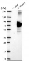 Anti-TOR1AIP2 antibody produced in rabbit 