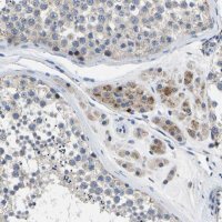 Anti-TOR1B antibody produced in rabbit HPA013697-100UL