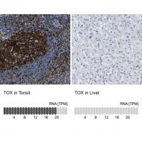Anti-TOX antibody produced in rabbit 