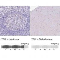 Anti-TOX2 antibody produced in rabbit