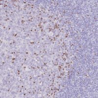 Anti-TOX2 antibody produced in rabbit