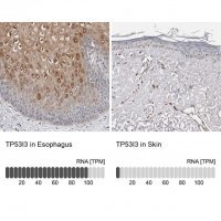 Anti-TP53I3 antibody produced in rabbit