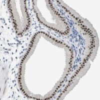 Anti-TP53RK antibody produced in rabbit HPA015837-100UL