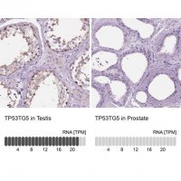 Anti-TP53TG5 antibody produced in rabbit 