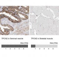 Anti-TPCN2 antibody produced in rabbit 
