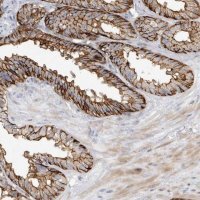 Anti-TPCN2 antibody produced in rabbit 
