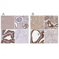 Anti-TPD52 antibody produced in rabbit HPA062167-100UL