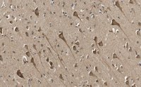 Anti-TPH-1 Antibody, clone 3J7 ZooMAb� Rabbit Monoclonal 