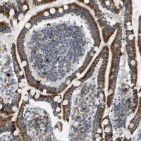 Anti-TPH1 antibody produced in rabbit