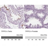 Anti-TPPP2 antibody produced in rabbit 