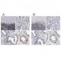 Anti-TPR antibody produced in rabbit 