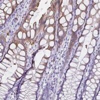 Anti-TPSG1 antibody produced in rabbit 