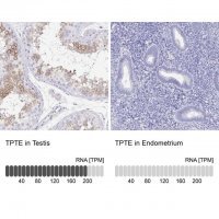 Anti-TPTE antibody produced in rabbit 