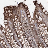Anti-TRAF3IP2 antibody produced in rabbit 