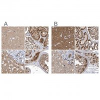Anti-TRAIP antibody produced in rabbit 
