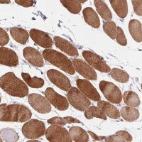 Anti-TRDN antibody produced in rabbit 
