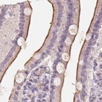 Anti-TREH antibody produced in rabbit 