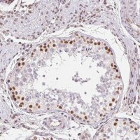 Anti-TRERF1 antibody produced in rabbit