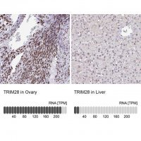 Anti-TRIM28 antibody produced in rabbit 