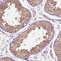 Anti-TRIM69 antibody produced in rabbit HPA028894-100UL