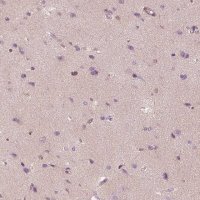 Anti-TRIM69 antibody produced in rabbit HPA028894-100UL