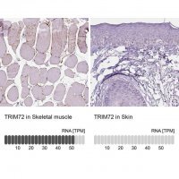 Anti-TRIM72 antibody produced in rabbit 
