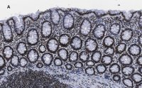 Anti-trimethyl-Histone H3 (Lys4) Antibody, clone MC315, ZooMAb� Rabbit Monoclonal 