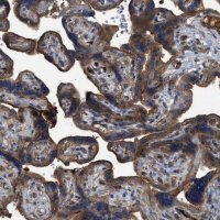 Anti-TRIOBP antibody produced in rabbit 