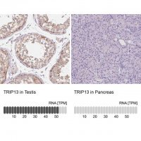 Anti-TRIP13 antibody produced in rabbit 