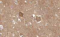 Anti-Trk-B Antibody, clone 2B22 ZooMAb� Rabbit Monoclonal 