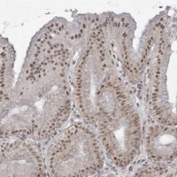 Anti-TRMT10C antibody produced in rabbit 