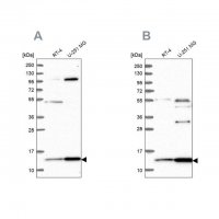 Anti-TRMT112 antibody produced in rabbit 