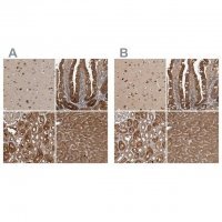 Anti-TRMT61B antibody produced in rabbit 