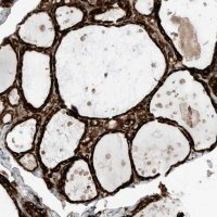 Anti-TRNAU1AP antibody produced in rabbit HPA032069-100UL