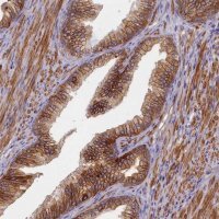 Anti-TRPM4 antibody produced in rabbit