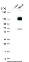 Anti-TRPM5 antibody produced in rabbit