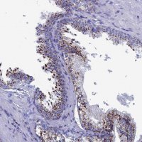 Anti-TRPM5 antibody produced in rabbit