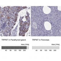 Anti-TRPM7 antibody produced in rabbit 