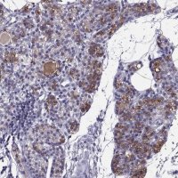 Anti-TRPM7 antibody produced in rabbit