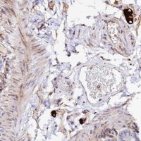 Anti-TRPV2 antibody produced in rabbit 