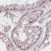 Anti-TRUB1 antibody produced in rabbit 