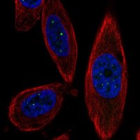 Anti-TSACC antibody produced in rabbit 