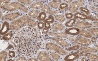 Anti-TSC2 Antibody, clone 4H10 ZooMAb� Rabbit Monoclonal 