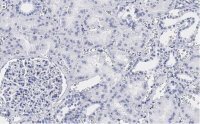Anti-TSC2 Antibody, clone 4H10 ZooMAb� Rabbit Monoclonal 