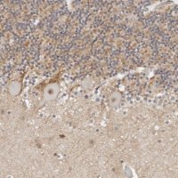 Anti-TSEN2 antibody produced in rabbit 