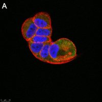 Anti-TSG101 Antibody, clone 2H18 ZooMAb� Rabbit Monoclonal 