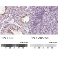 Anti-TSKS antibody produced in rabbit