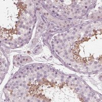 Anti-TSKS antibody produced in rabbit